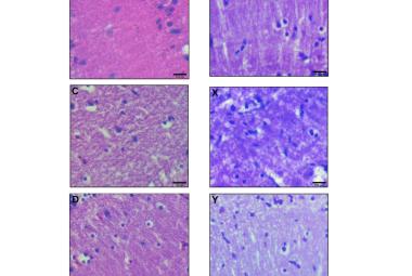Microscopic appearance of ventral diencephalon stained with H & E (left) and cresyl violet (right) in different treated groups. A and V: normal group; B and W: negative (MPTP-treated) group; C and X: LD (25 mg/L) group; D and Y: MD (50 mg/L) group and E and Z: HD (100 mg/L) group