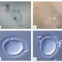This showed oocytes denudation process. (A) Cumulus Oocytes Complex prepared for mechanical denudation without enzyme; (B) Cumulus Oocytes Complex enzymolysed in hyaluronidase; (C) “Naked” oocytes following enzymolysed in hyaluronidase – clean edge; (D) “Naked” oocytes following mechanical denudation – minimal cumulus cell at the edge